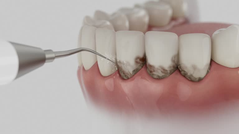 Reliable Tooth Extraction contractor in Echols County County, GA by Dentist Open Now